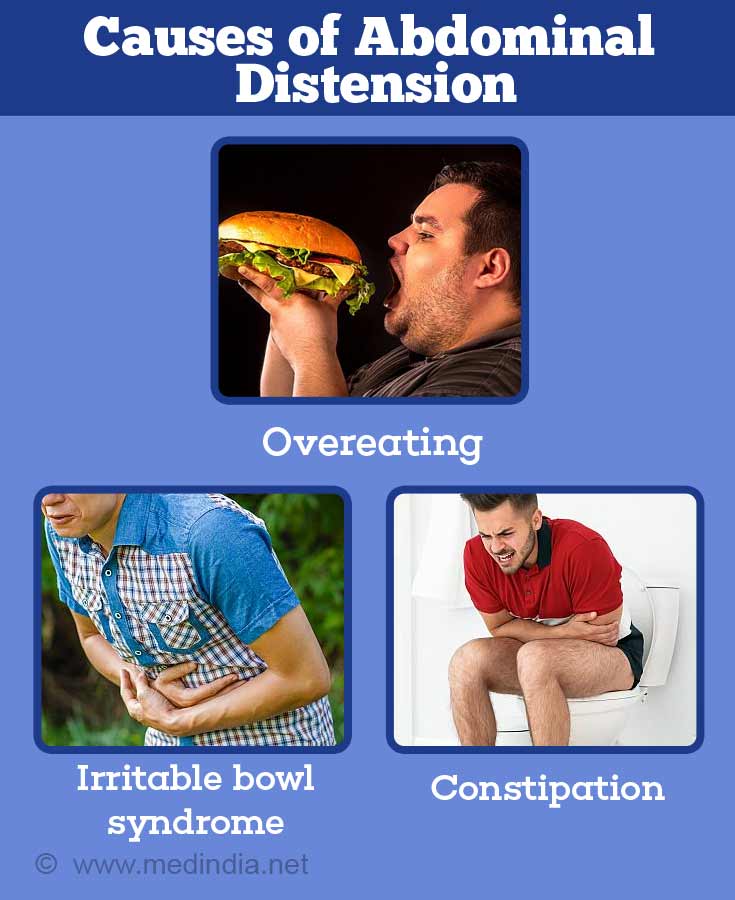 Causes of Abdominal Distension Causes of Abdominal Distension