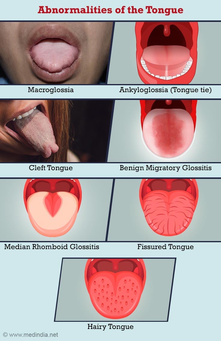 Tongue depressor - Wikipedia