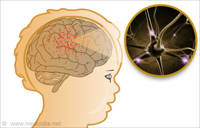 Acquired Epileptiform Aphasia Epilepsy Acquired Epileptiform Aphasia Epilepsy