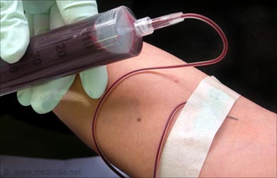 Diagnosis of Adrenal Gland Disorders: Blood Test Diagnosis of Adrenal Gland Disorders: Blood Test
