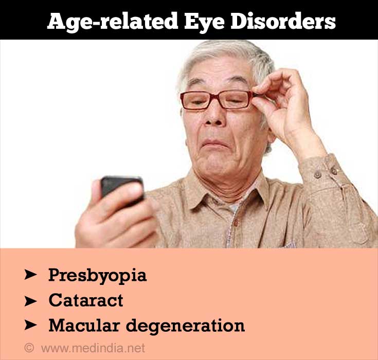 Age-related Eye Disorders Age-related Eye Disorders