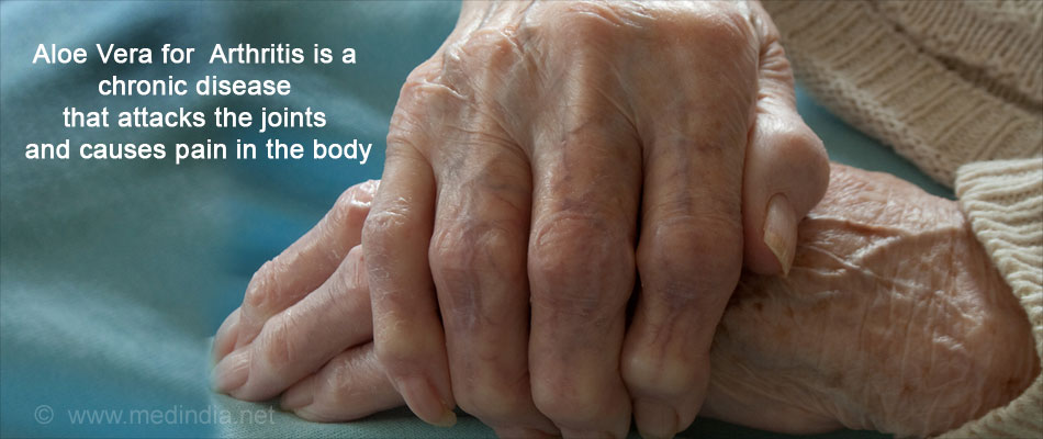 Health Benefits of Aloe Vera: Arthritis Health Benefits of Aloe Vera: Arthritis