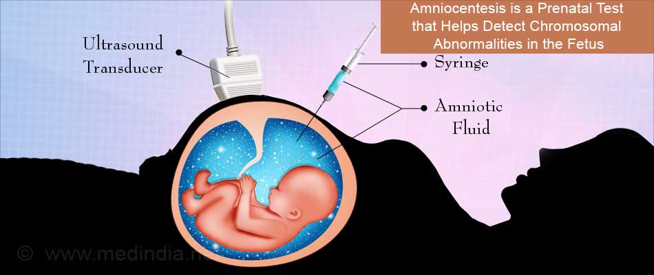 Erythroblastosis Fetalis Causes Symptoms Diagnosis Treatment Prevention