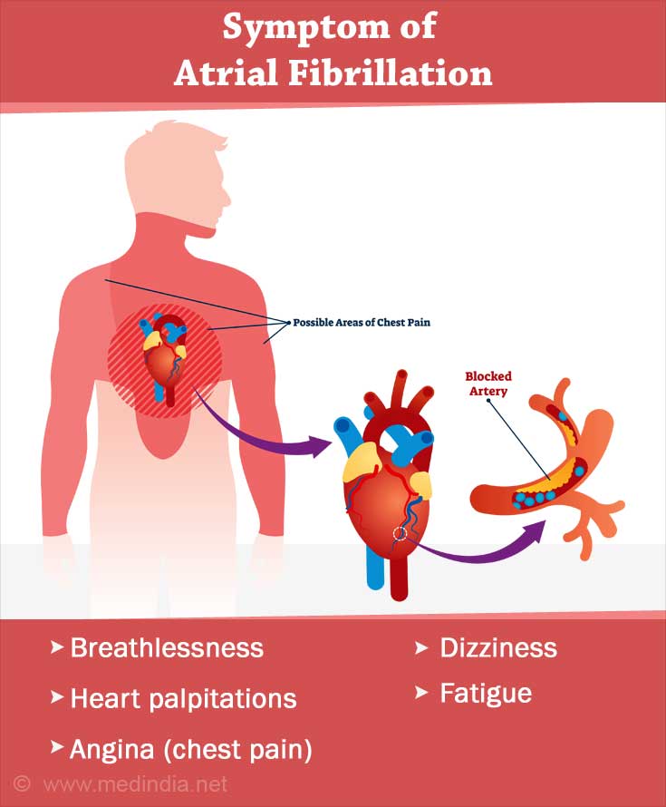 Atrial Fibrillation - Causes, Symptoms, Diagnosis, Treatment 