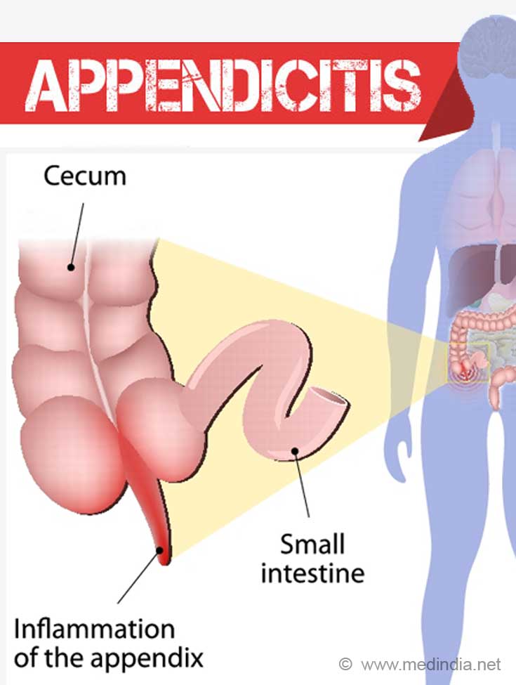 Food Poisoning Symptom Evaluation