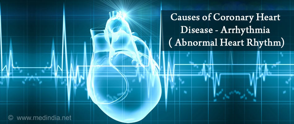 Coronary Heart Disease - Causes, Symptoms, Risk Factors, Diagnosis ...