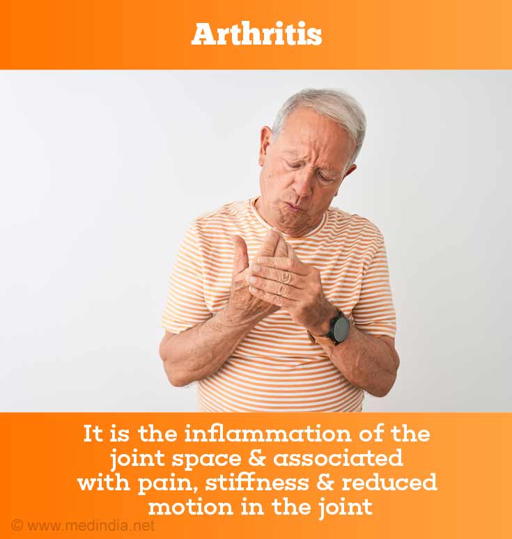 What is Arthritis?