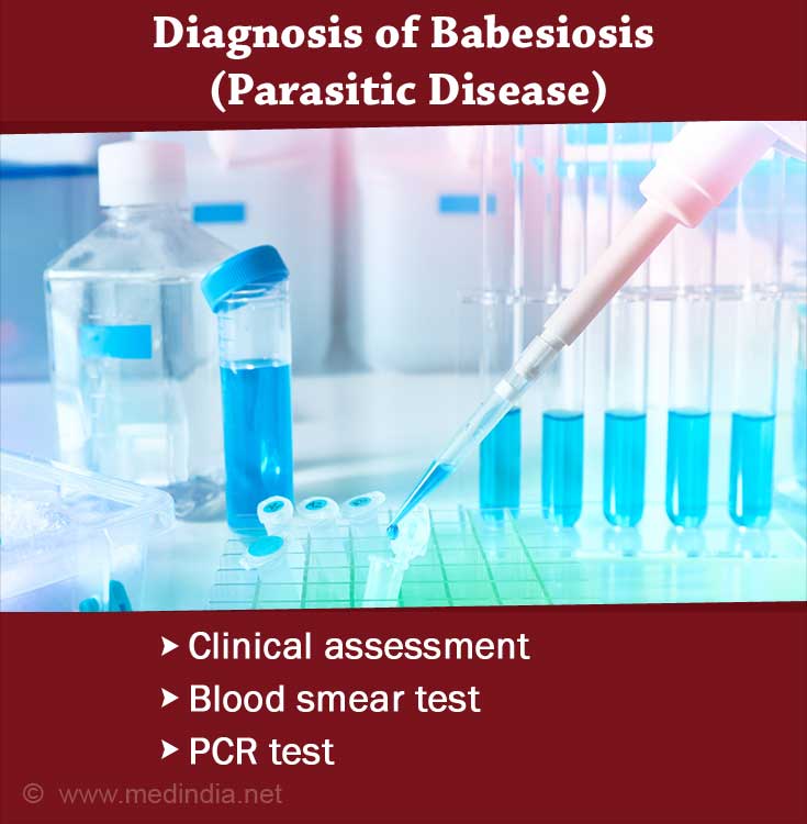 Babesiosis | Babesia - Causes, Symptoms, Diagnosis, Treatment