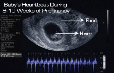 Baby�s Heart Beat during 8-10 Weeks of Pregnancy Baby�s Heart Beat during 8-10 Weeks of Pregnancy