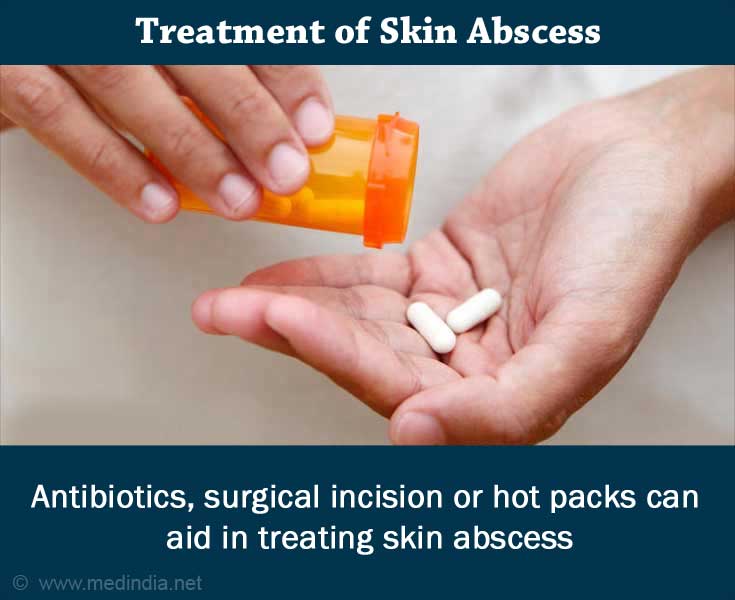 Boils: Antibiotics Boils: Antibiotics