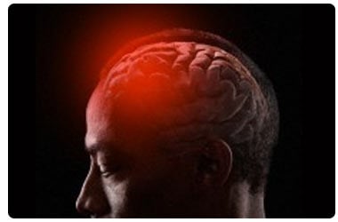 Head Injury | Brain Injury Overview Types Causes Symptoms Diagnosis ...