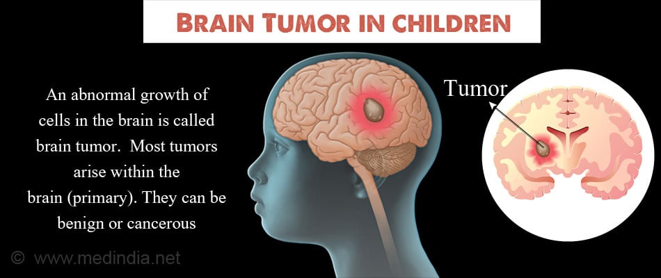 First Signs Of Brain Tumors In Child Accelerating Diagnosis For