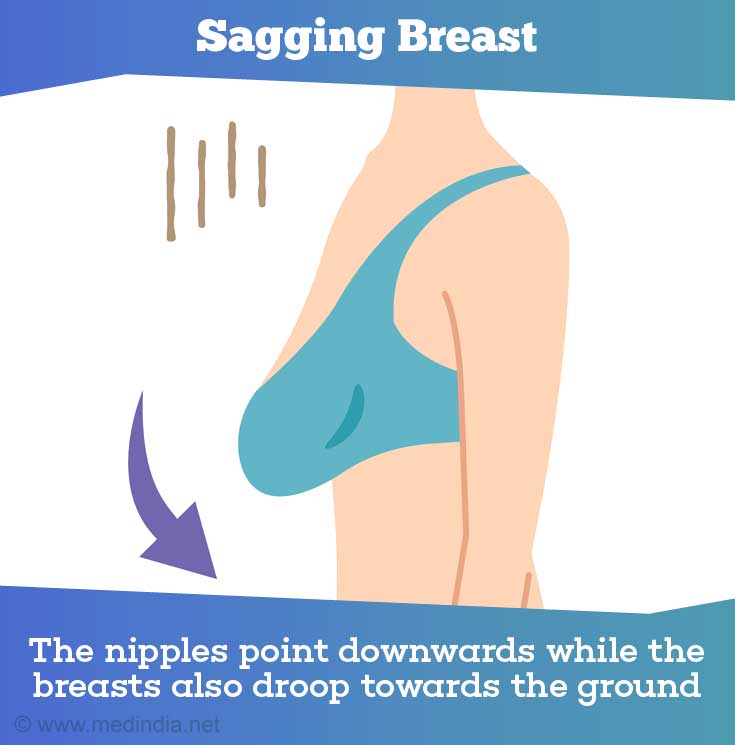 Breast Cancer Scare