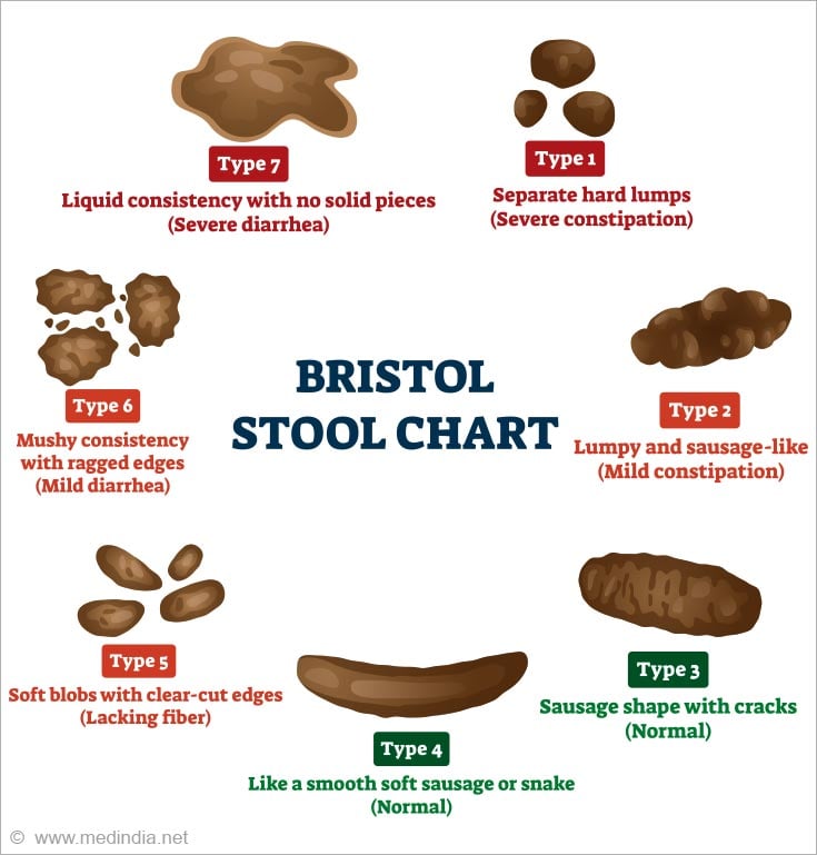 foul-smelling-stool