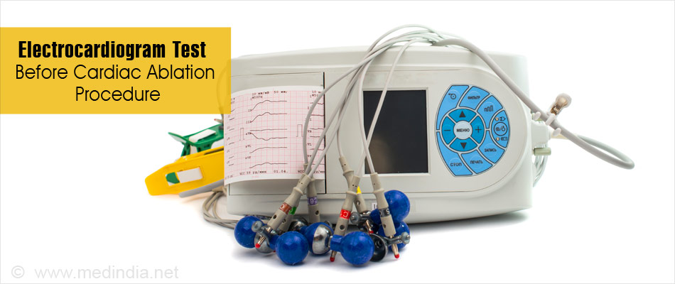 Electrocardiogram Electrocardiogram
