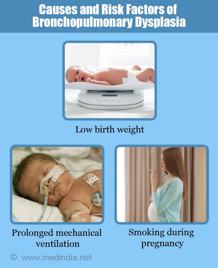 Bronchopulmonary Dysplasia | Respiratory Insufficiency - Causes ...