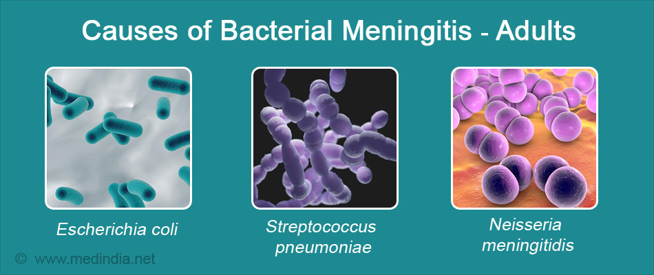 Bacterial Meningitis Symptoms