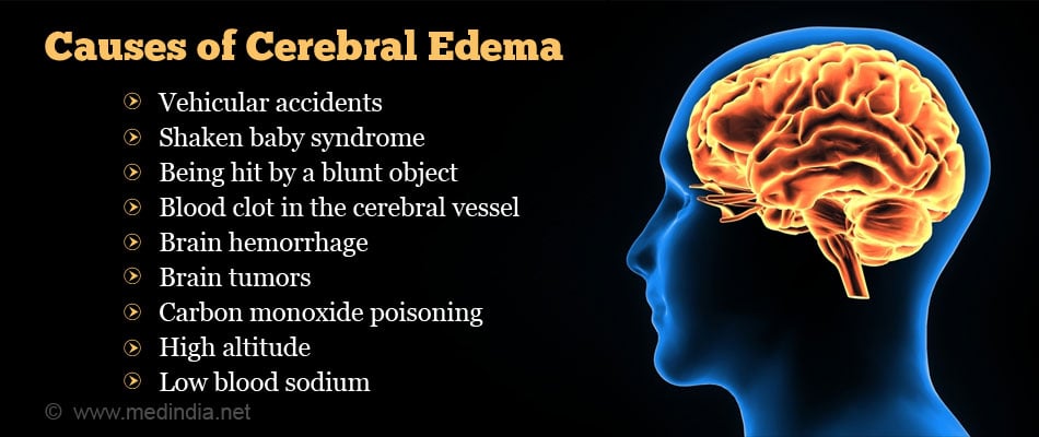 Cerebral Edema - Causes Symptoms Diagnosis Treatment Prevention