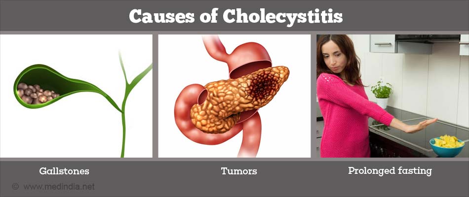 Cholecystitis Treatment