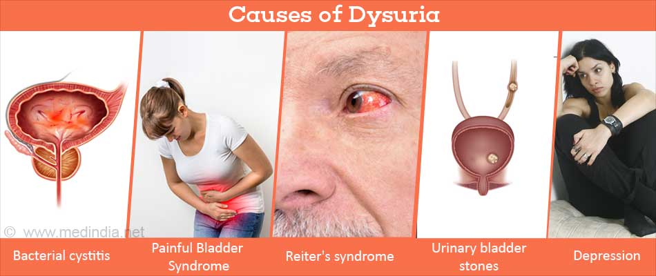 Dysuria, Painful Micturition