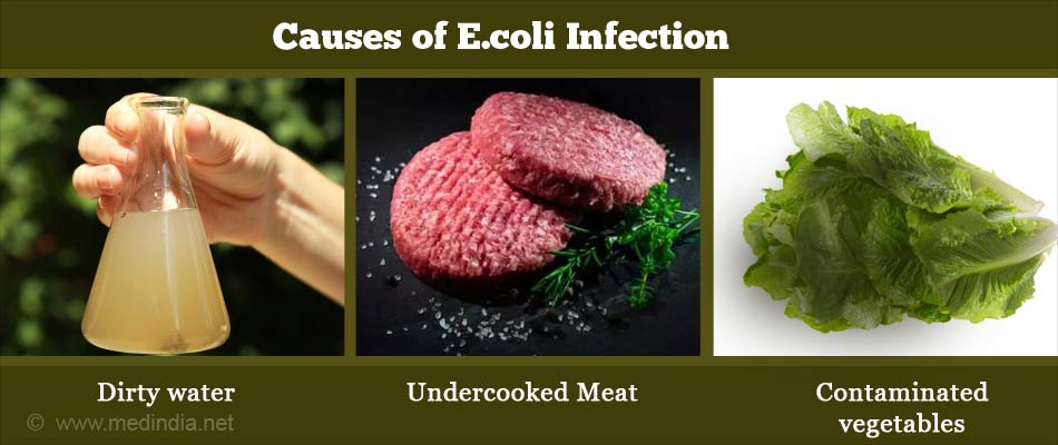 E Coli Infections Pictures