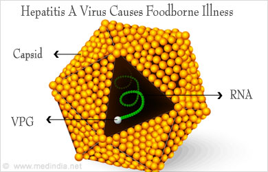 Causes of Foodborne Illnesses Causes of Foodborne Illnesses