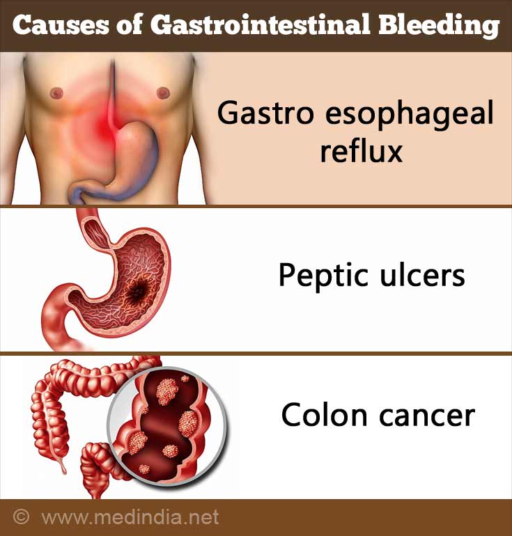 blood in stool upper gi tract
