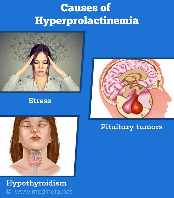 Hyperprolactinemia in Women: Symptoms, Causes, and Treatment