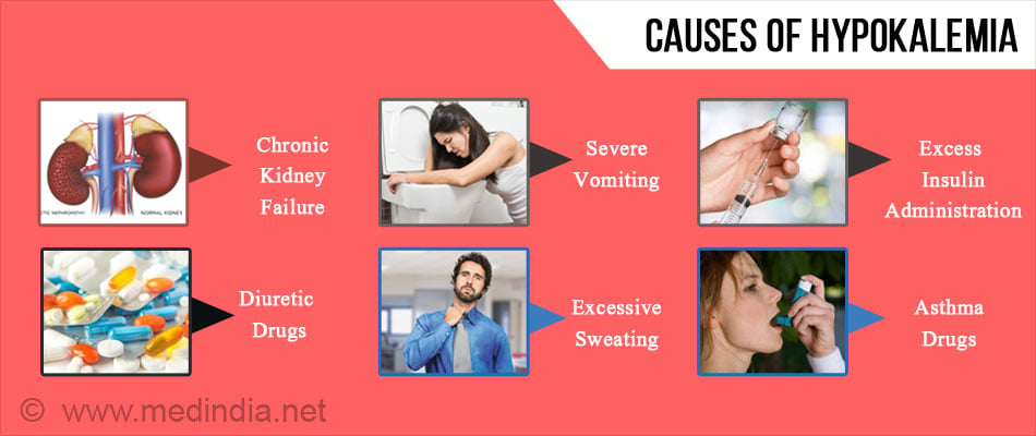 Hypokalemia - Causes, Symptoms, Diagnosis, Treatment & Prevention