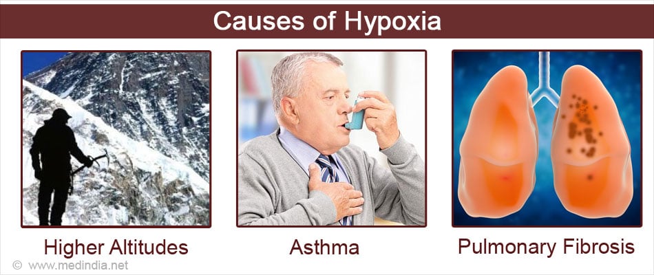 Hypoxia - Types, Causes, Symptoms, Complications, Diagnosis, Treatment ...