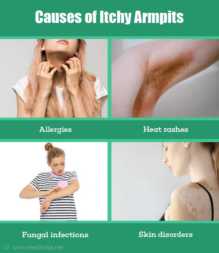 Itchy Armpits Causes Prevention And Treatment 8790