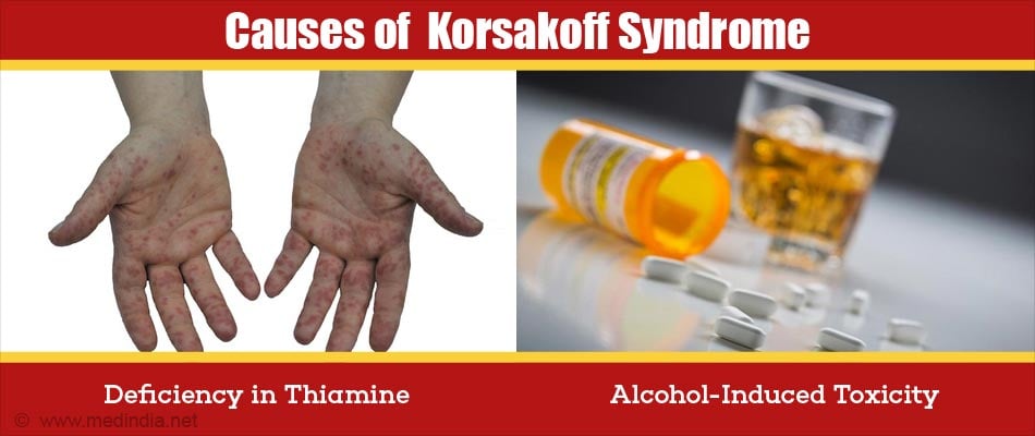 Wernicke Korsakoff Syndrome