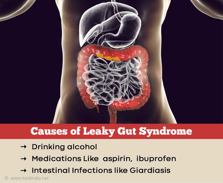 Causes of Leaky Gut Syndrome