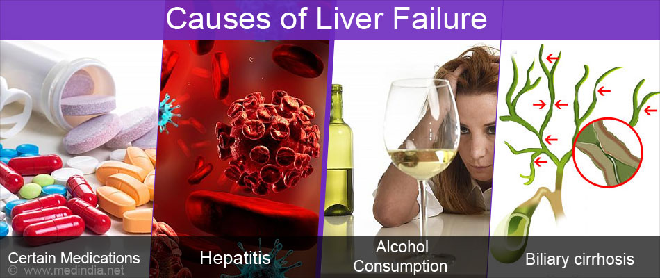 which-states-had-the-most-deaths-linked-to-liver-disease-hep