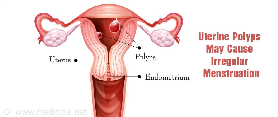 Menstrual Cycle - Phases, Mechanism, Causes, Prevention and Myths