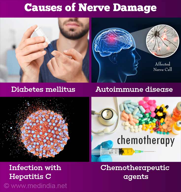 how long does nerve damage from blood draw last Breanna Bertram