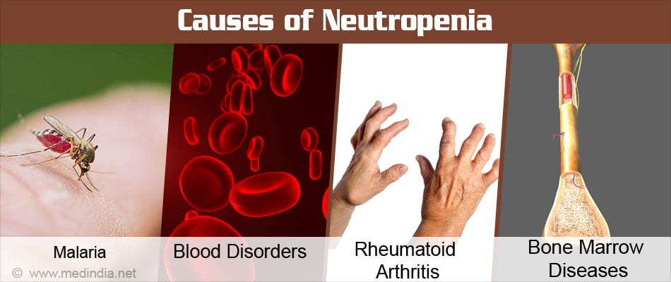 neutropenia