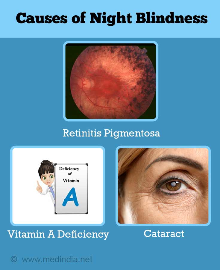 Is Night Blindness Caused By Genetics