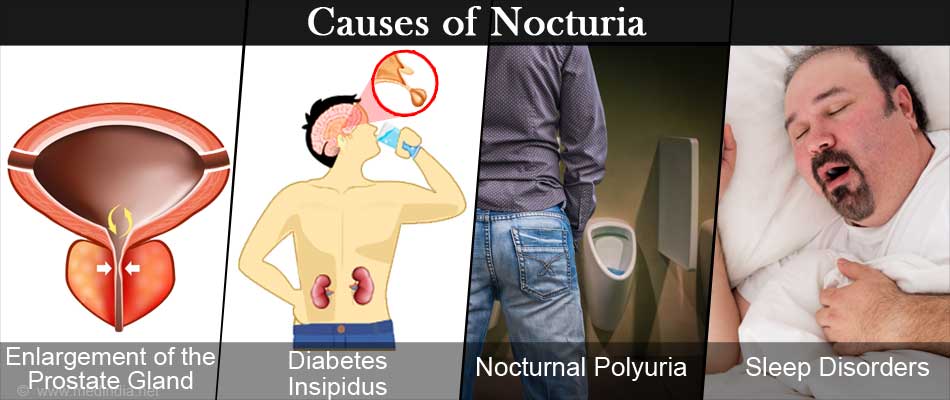 Nocturia: Causes and Treatments for Frequent Urination