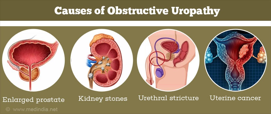 Symptoms Of Obstructive Uropathy