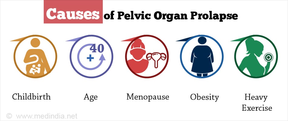Types Of Pelvic Organ Prolapse