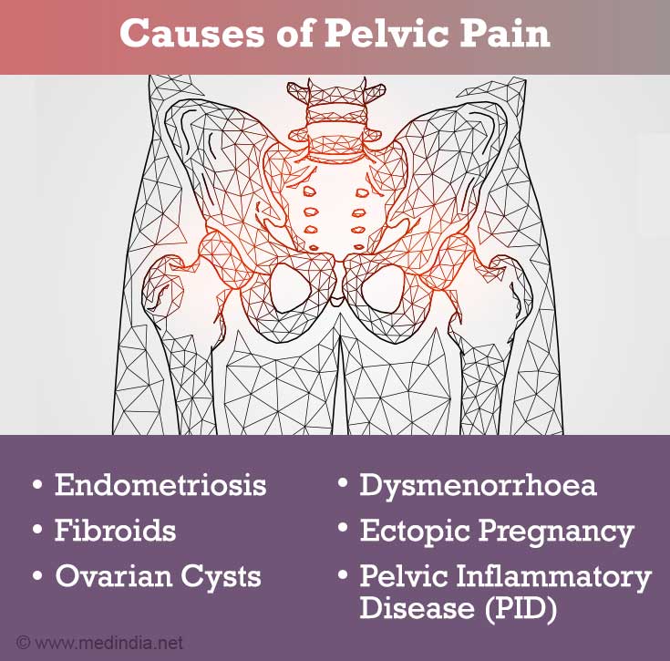 Pelvic Ct Scan Causes Symptoms Treatment Pelvic Ct Scan - Bank2home.com