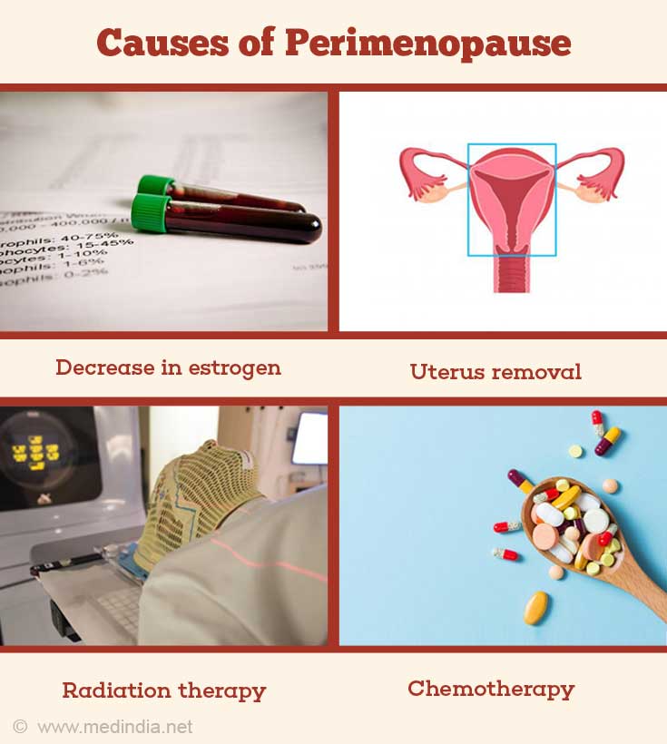 perimenopause-causes-symptoms-diagnosis-and-treatment