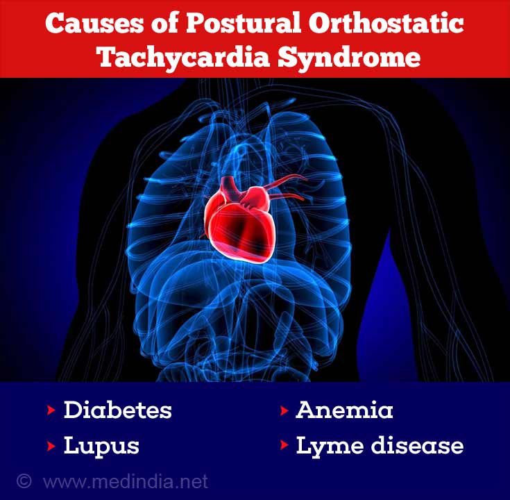 Postural Orthostatic Tachycardia Syndrome (POTS) - Causes, Symptoms,  Diagnosis, Treatment and Prognosis