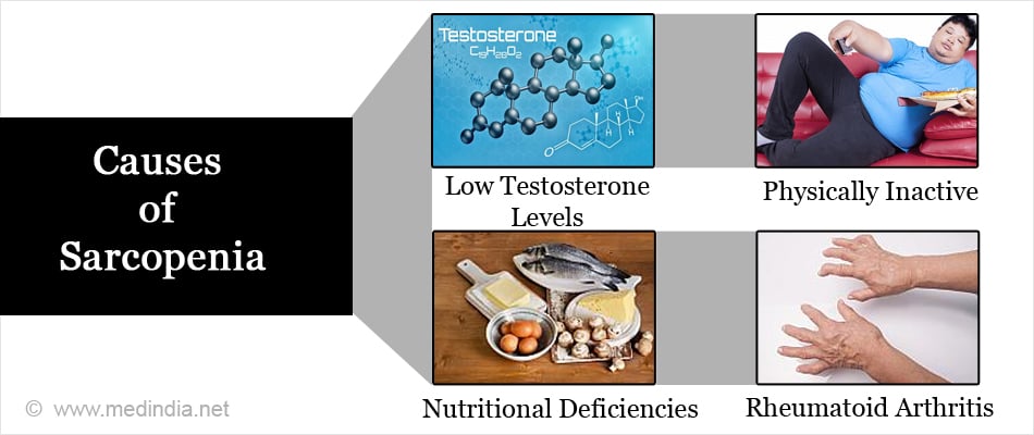 Causes of Sarcopenia Causes of Sarcopenia