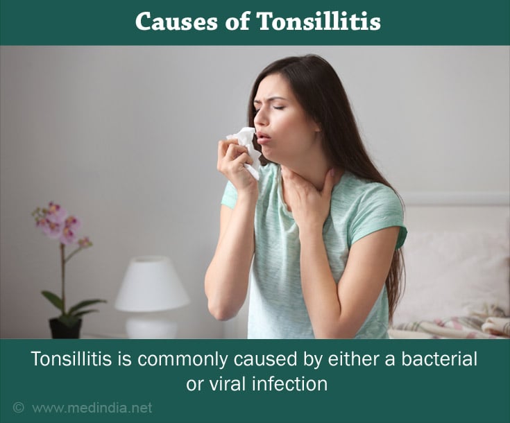 Causes of Tonsillitis