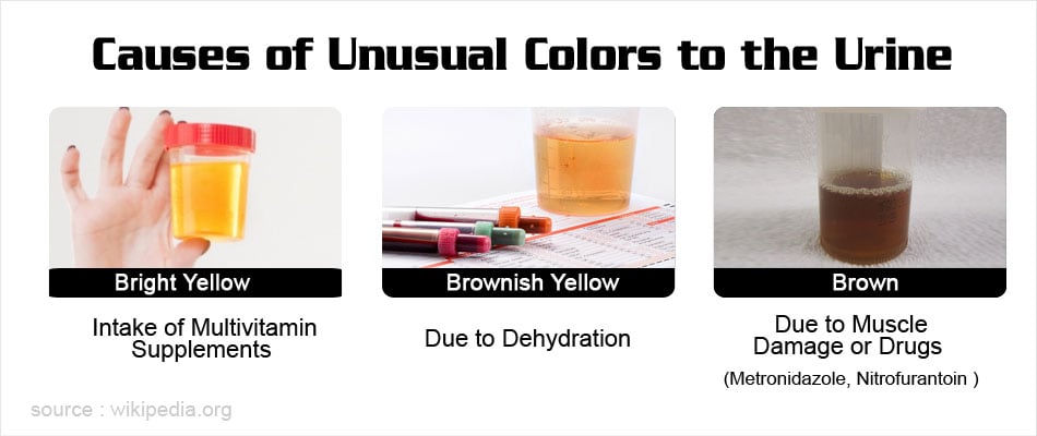 Urine Color And Odor Chart