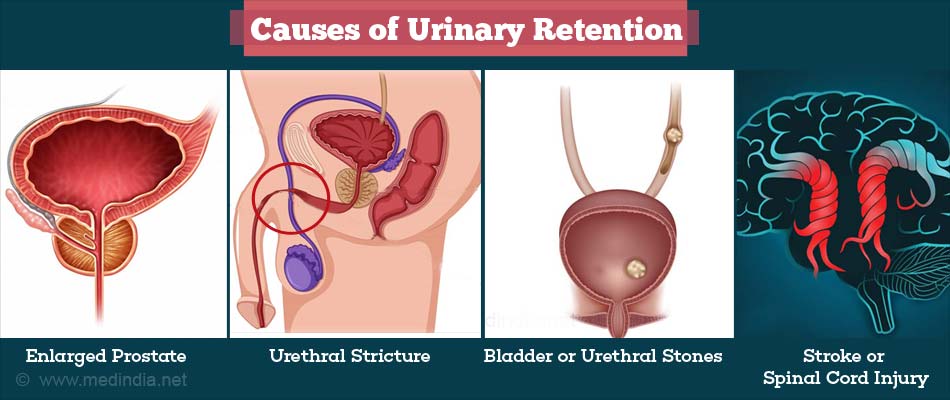 which cues support the hypothesis of urinary retention