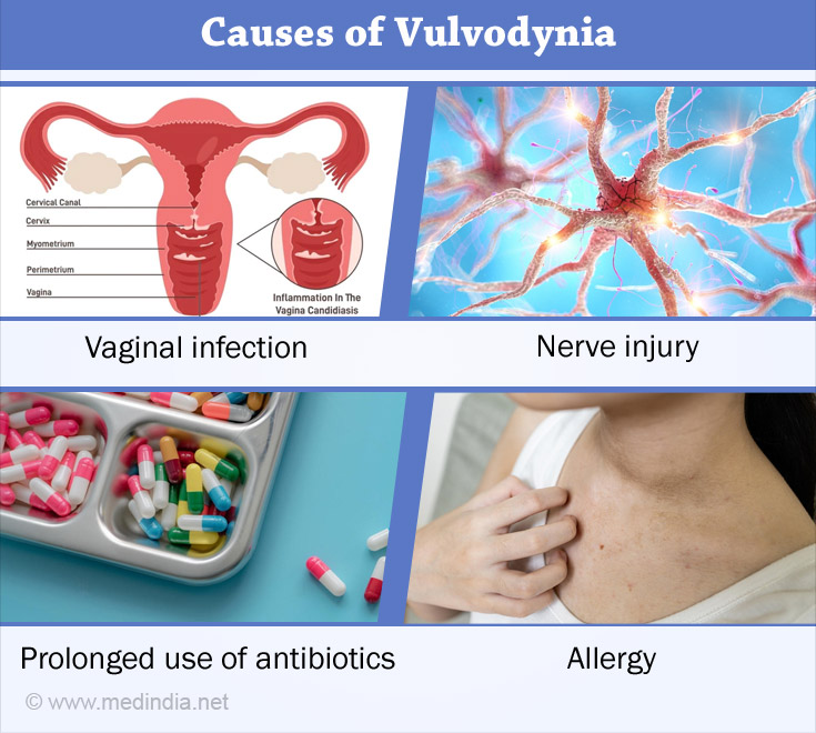 Vulvodynia Causes