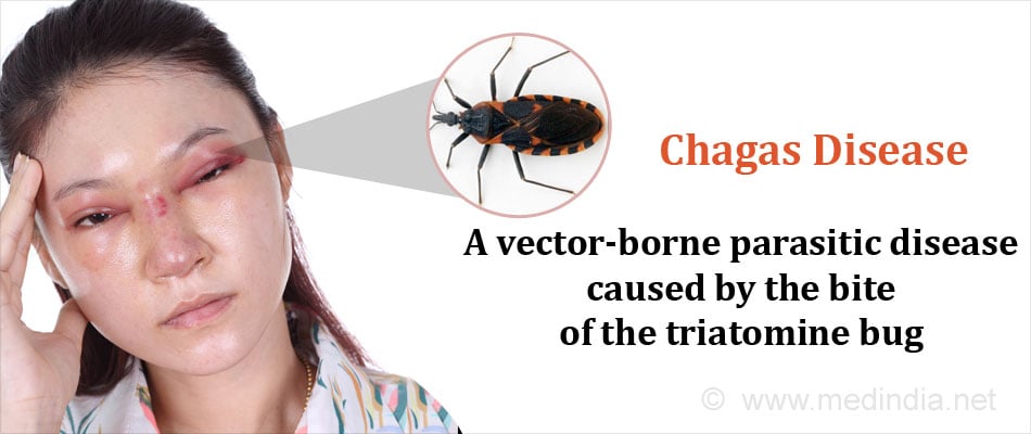 Nursing Paper Example on Chagas Disease: Causes, Symptoms, Diagnosis, Treatment, and Patient Education